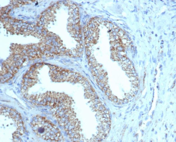 Formalin-fixed, paraffin-embedded human prostate stained with PMEPA1 Recombinant Mouse Monoclonal (rPMEPA1/6422).