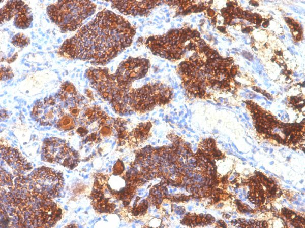 Formalin-fixed, paraffin-embedded human Parathyroid Gland stained with PTH Mouse Monoclonal Antibody (PTH/1175).