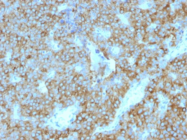 Formalin-fixed, paraffin-embedded human Parathyroid Gland stained with PTH Mouse Monoclonal Antibody (PTH/1175).