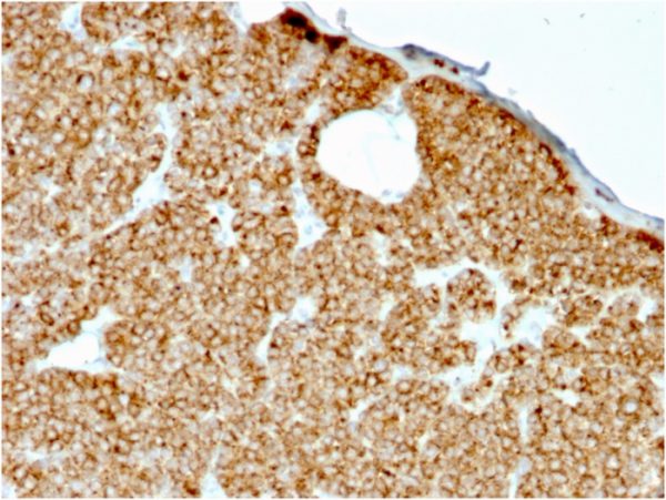 Formalin-fixed, paraffin-embedded human Parathyroid stained with PTH Mouse Recombinant Monoclonal Antibody (rPTH/911).