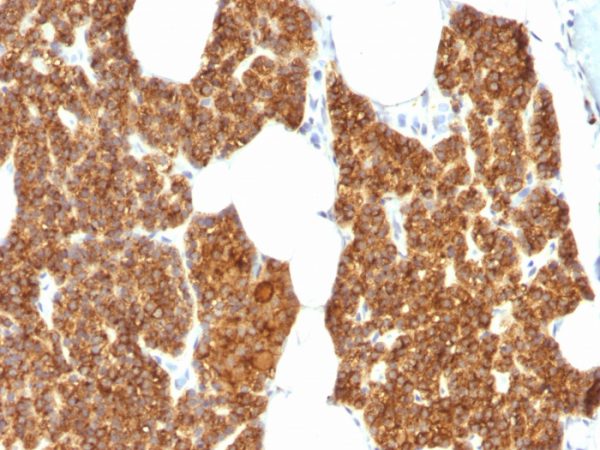 Parathyroid Hormone (PTH) (N-Terminal) Antibody