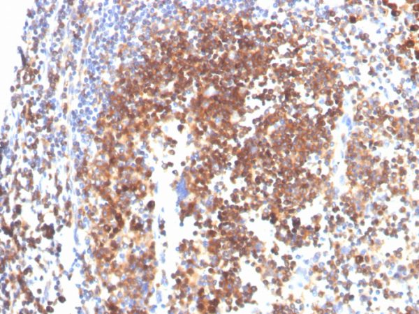 Formalin-fixed, paraffin-embedded human tonsil stained with SLAMF7 / CS1 Mouse Monoclonal Antibody (SLAMF7/3649).