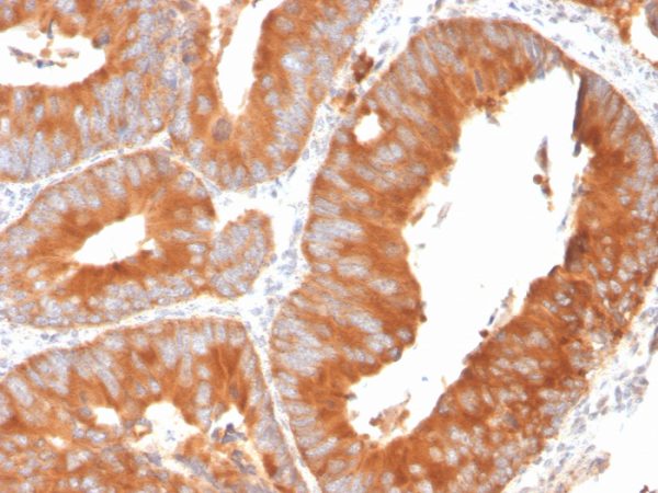 Formalin-fixed, paraffin-embedded human spleen stained with SLAMF7 / CS1 Mouse Monoclonal Antibody (SLAMF7/3649).