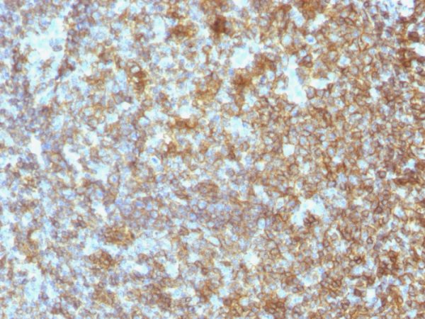 CD45 / LCA (Leucocyte Marker) Antibody