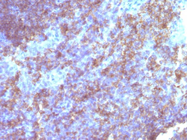 CD45 / LCA (Leucocyte Marker) Antibody - Image 2