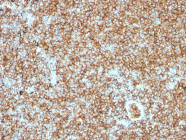 CD45RB (B-Cell Marker) Antibody