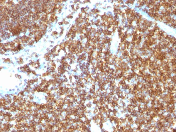 CD45RB (B-Cell Marker) Antibody - Image 2