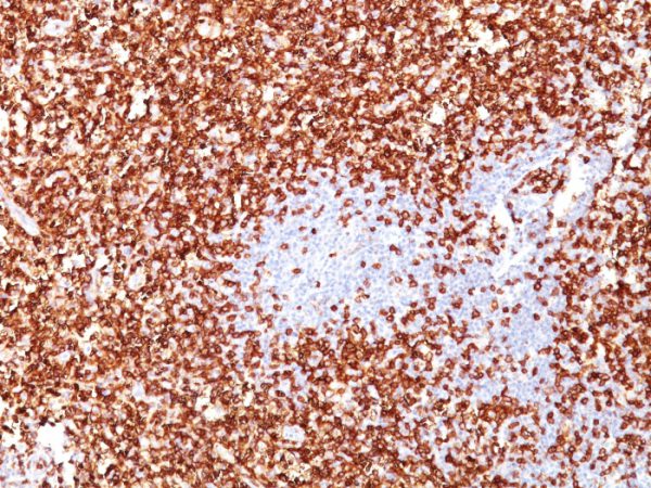 Formalin-fixed, paraffin-embedded human Tonsil stained with CD45RO Monoclonal Antibody (UCHL-1 + T200/797).