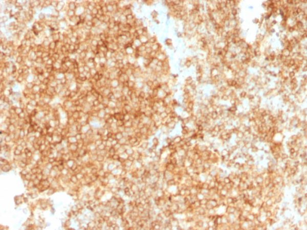 CD45 / LCA (Leucocyte Marker) Antibody