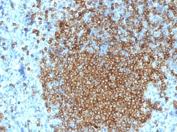 Formalin-fixed, paraffin-embedded human Spleen stained with CD45RA Mouse Monoclonal Antibody (K4B5).