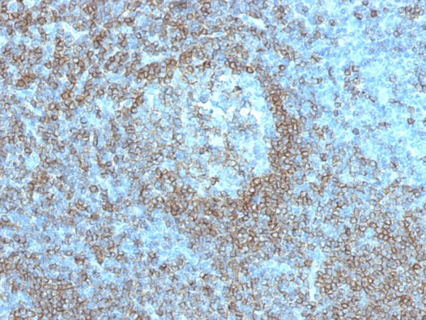 Formalin-fixed, paraffin-embedded human Tonsil stained with CD45RA Mouse Monoclonal Antibody (K4B5).