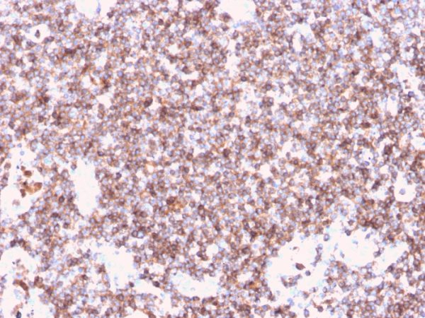 Recombinant CD45 / LCA (B-Cell Marker) Antibody