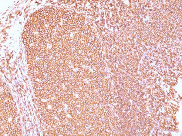 Formalin-fixed, paraffin-embedded human Tonsil stained with CD45RB Mouse Monoclonal Antibody (PD7/26).