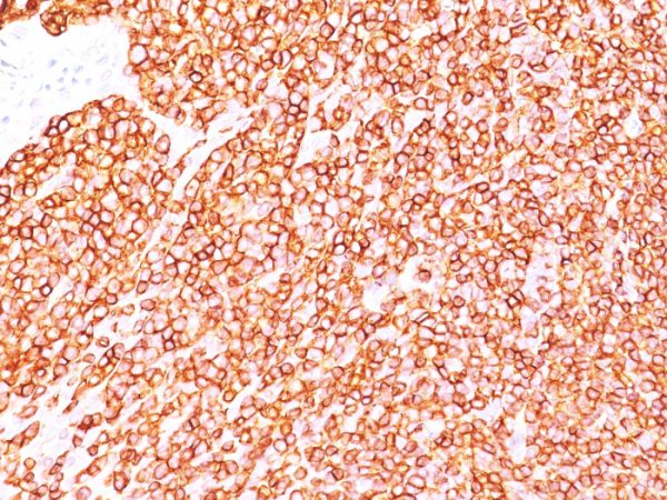 Formalin-fixed, paraffin-embedded human Tonsil stained with CD45RB Mouse Monoclonal Antibody (PD7/26).