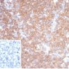 Recombinant CD45RA / LCA (B-Cell Marker) Antibody