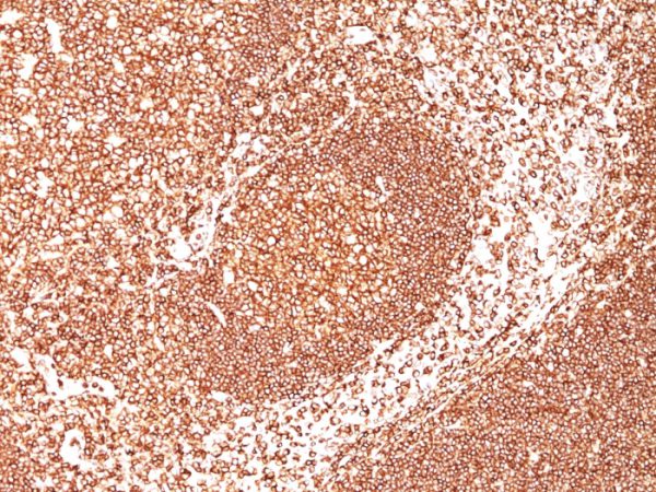 CD45 Antibody in Immunohistochemistry (IHC (P))