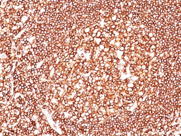 CD45 Antibody in Immunohistochemistry (IHC (P))