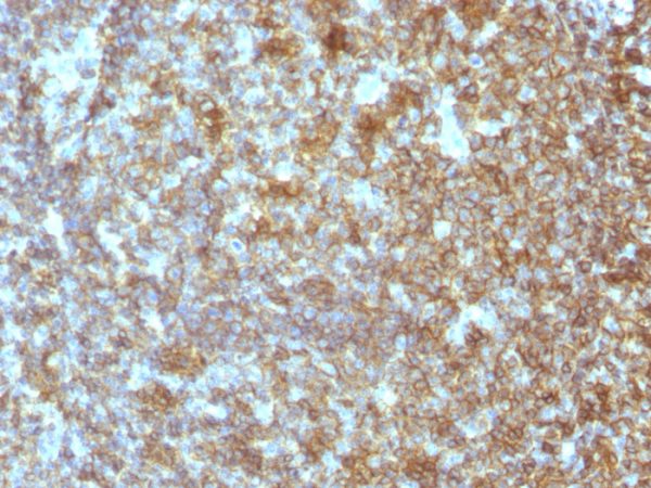 CD45RA (Leucocyte Marker) Antibody