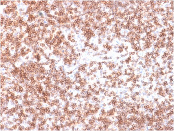 Recombinant CD45 / LCA (B-Cell Marker) Antibody