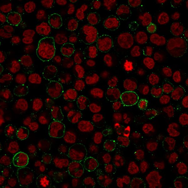 Recombinant CD45 / LCA (B-Cell Marker) Antibody - Image 5