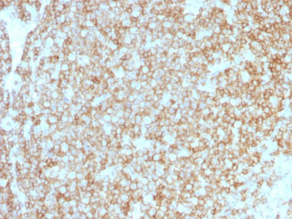 Formalin-fixed, paraffin-embedded human Tonsil stained with CD45 Recombinant Rabbit Monoclonal Antibody (PTPRC/1783R + PTPRC/1975R).