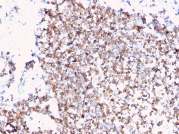 Formalin-fixed, paraffin-embedded human tonsil stained with CD45 Recombinant Rabbit Monoclonal Antibody (PTPRC/3881R).