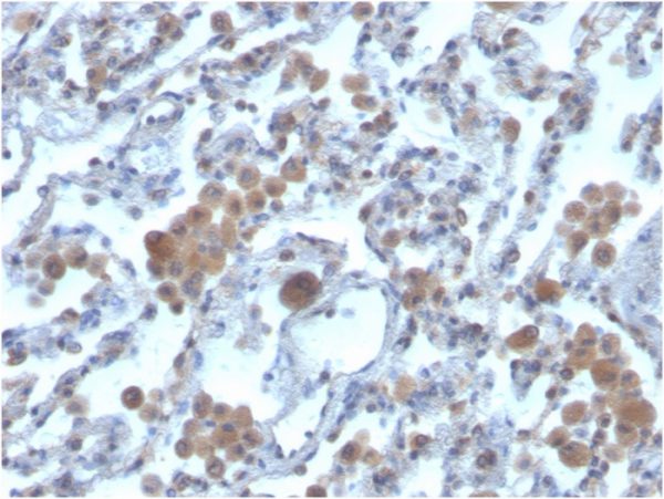 Formalin-fixed, paraffin-embedded human lung stained with RAC1Mouse Monoclonal Antibody (CPTC-RAC1-1).