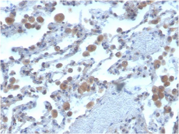 Formalin-fixed, paraffin-embedded human lung stained with RAC1Mouse Monoclonal Antibody (CPTC-RAC1-1).