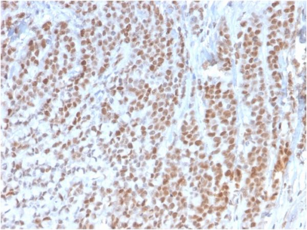 Rb1 (Tumor Suppressor Protein) Antibody