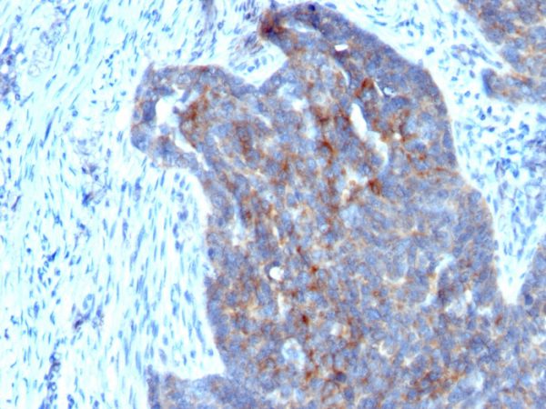 Retinol Binding Protein-1 (RBP1) Antibody - Image 2