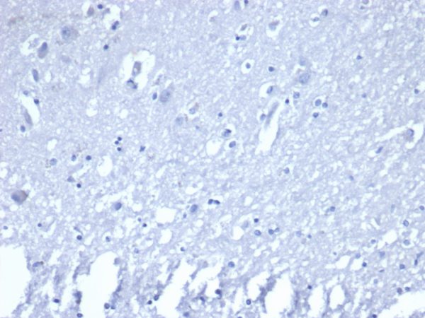 IHC analysis of formalin-fixed, paraffin-embedded human brain. Negative tissue control using RORC/2941 at 2ug/ml in PBS for 30min RT. HIER: Tris/EDTA, pH9.0, 45min. 2 °: HRP-polymer, 30min. DAB, 5min.