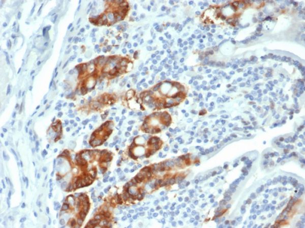 Formalin-fixed, paraffin-embedded human small intestine stained with RRM1 Recombinant Rabbit Monoclonal (RRM1/4372R).