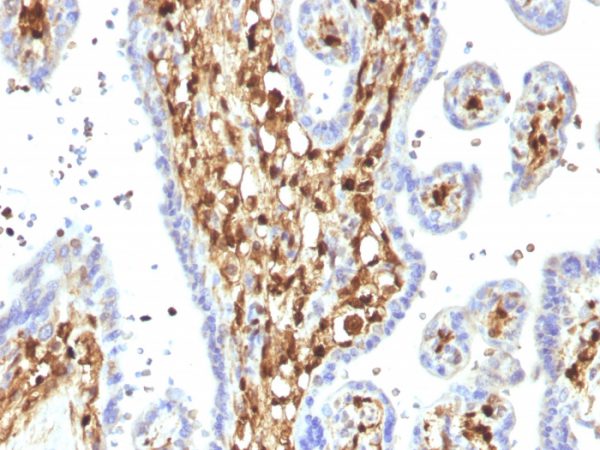 S100A4 / Metastasin / Calvasculin (Marker of Tumor Metastasis) Antibody