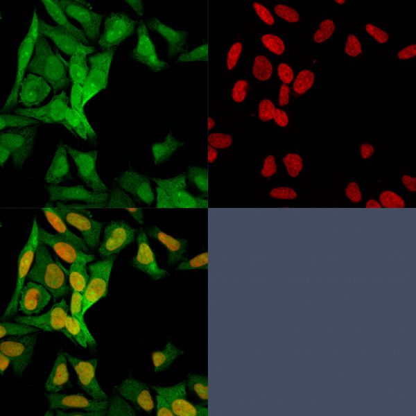 S100A4 / Metastasin / Calvasculin (Marker of Tumor Metastasis) Antibody - Image 7