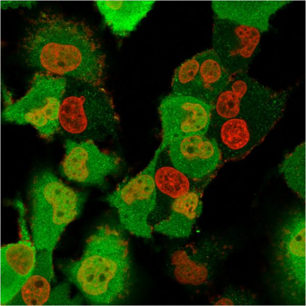 S100A4 / Metastasin / Calvasculin (Marker of Tumor Metastasis) Antibody - Image 4