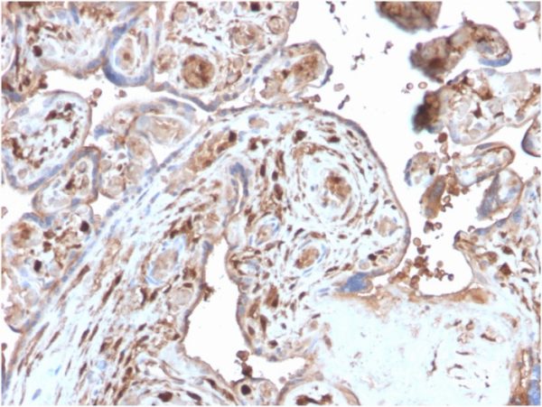 Formalin-fixed, paraffin-embedded human Placenta stained with S100A4 Recombinant Rabbit Monoclonal Antibody (S100A4/2750R).