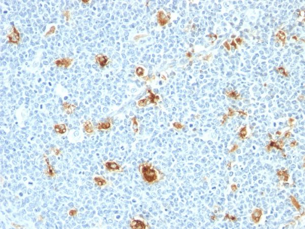 Formalin-fixed, paraffin-embedded human tonsil stained with Calgranulin B Monoclonal Antibody (CAGB/426)
