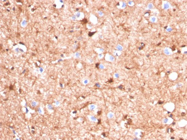 S100B (Astrocyte and Melanoma Marker) Antibody