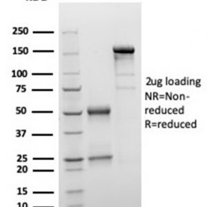 SDS-PAGE Analysis of Purified S100B Mouse Monoclonal Antibody (S100B/4149). Confirmation of Purity and Integrity of Antibody.