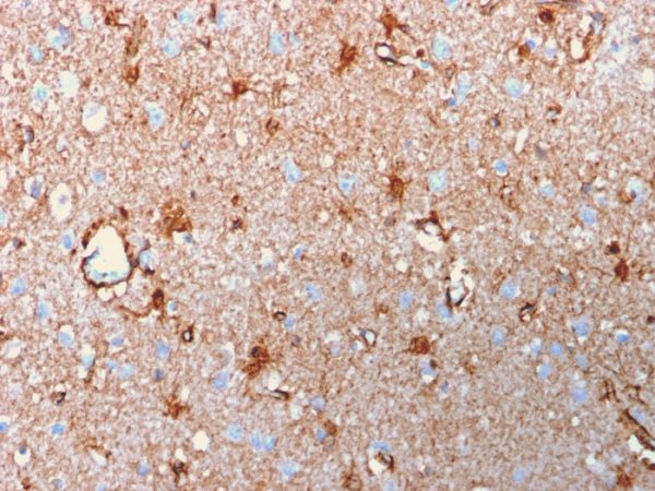 Formalin-fixed, paraffin-embedded human brain stained with S100B Mouse Recombinant Monoclonal Antibody (rS100B/1896).