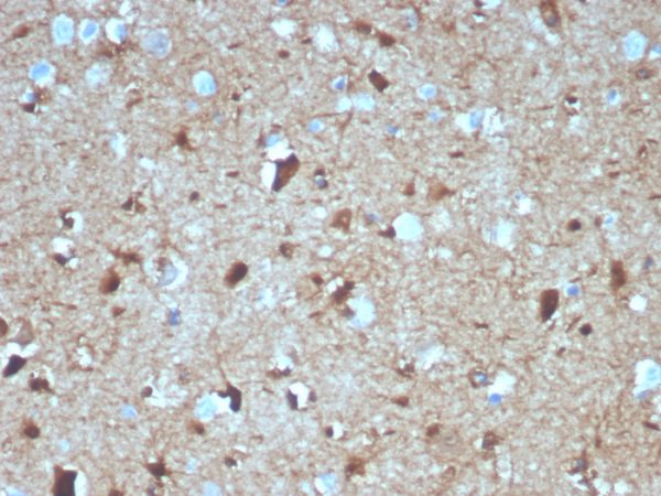 Formalin-fixed, paraffin-embedded human brain stained with S100B Mouse Monoclonal Antibody (S100B/4139).