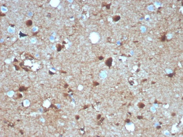 Formalin-fixed, paraffin-embedded human brain stained with S100B Mouse Monoclonal Antibody (S100B/4139).