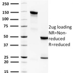 SDS-PAGE Analysis of Purified Spermidine Monoclonal Antibody (CPTC-SAT1-3). Confirmation of Purity and Integrity of Antibody.