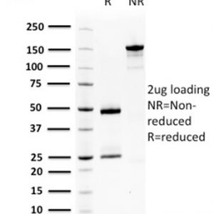 SDS-PAGE Analysis of Purified SqCC Antigen 1 Mouse Monoclonal Antibody (CPTC-SERPINB3-2). Confirmation of Purity and Integrity of Antibody.