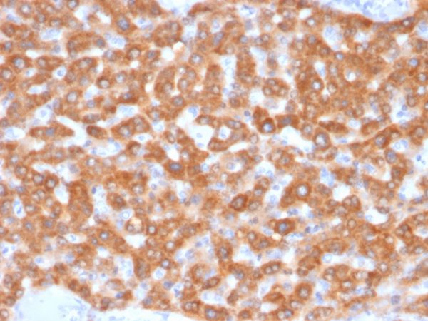 SDHB (Succinate Dehydrogenase B) (Pheochromocytoma Marker) Antibody