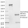 SDHB (Succinate Dehydrogenase B) (Pheochromocytoma Marker) Antibody