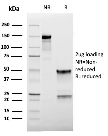 SDS-PAGE Analysis of Purified CD62L Mouse Monoclonal Antibody (LAM1-116). Confirmation of Purity and Integrity of Antibody.