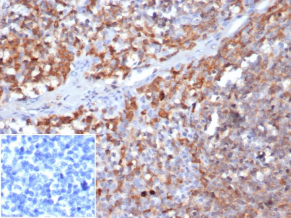 Formalin-fixed, paraffin-embedded human tonsil stained with Gamma parvin Mouse Monoclonal Antibody (8C5.2) at 2ug/ml in PBS. Inset: PBS instead of primary, secondary only antibody control.