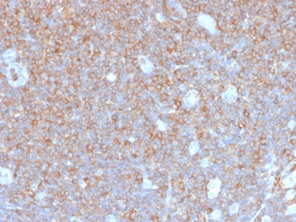 Recombinant Gamma-parvin (PARVG) Antibody - Image 2