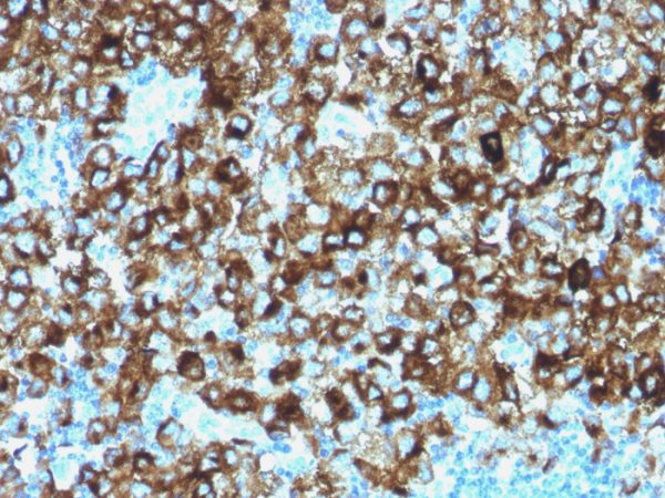 gp100 / Melanosome / PMEL17 / SILV (Melanoma Marker) Antibody